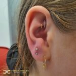 Fully Healed Double Rook with Hoops